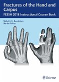 Fractures of the Hand and Carpus (eBook, PDF)