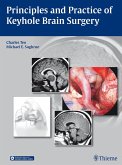 Principles and Practice of Keyhole Brain Surgery (eBook, PDF)