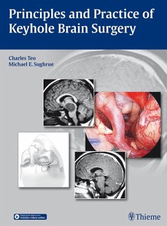 Principles and Practice of Keyhole Brain Surgery (eBook, PDF) Cover Principles and Practice of Keyhole Brain Surgery (eBook, PDF)