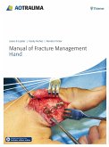 Manual of Fracture Management - Hand (eBook, PDF)
