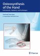 Osteosynthesis of the Hand (eBook, PDF) - Bild 1