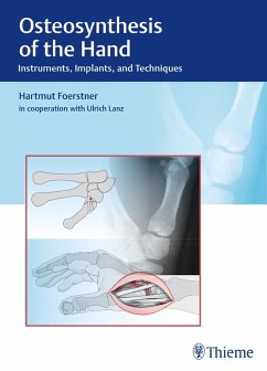 Osteosynthesis of the Hand (eBook, PDF) - Förstner, Hartmut