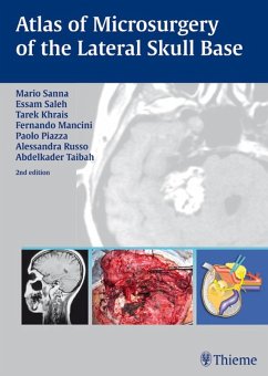 Atlas of Microsurgery of the Lateral Skull Base (eBook, PDF) - Sanna, Mario; Khrais, Tarek; Mancini, Fernando; Saleh, Essam A.; Piazza, Paolo; Russo, Alessandra; Taibah, Abdelkader