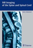 MR Imaging of the Spine and Spinal Cord (eBook, PDF)