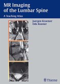 MR Imaging of the Lumbar Spine (eBook, PDF)