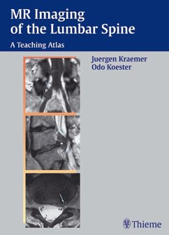 MR Imaging of the Lumbar Spine (eBook, PDF) - Kraemer, Juergen; Koester, Odo