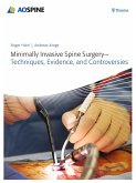 Minimally Invasive Spine Surgery - Techniques, Evidence, and Controversies (eBook, PDF)