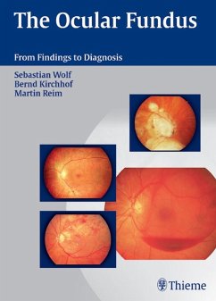 The Ocular Fundus (eBook, PDF) - Wolf, Sebastian; Reim, Martin; Kirchhof, Bernd