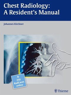 Chest Radiology: A Resident's Manual (eBook, PDF) - Kirchner, Johannes