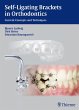 Self-Ligating Brackets in Orthodontics... - Bild 1