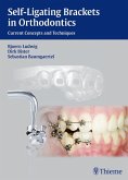 Self-Ligating Brackets in Orthodontics (eBook, PDF)