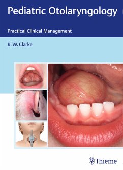 Pediatric Otolaryngology (eBook, PDF)