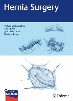 Cover Hernia Surgery (eBook, PDF)