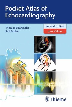 Pocket Atlas of Echocardiography (eBook, PDF) - Böhmeke, Thomas; Doliva, Ralf