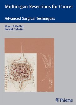 Multiorgan Resections for Cancer (eBook, PDF) - Martin, Ronald F.; Merlini, Marco