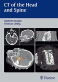 CT of the Head and Spine (eBook, PDF)
