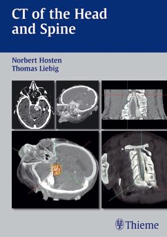 CT of the Head and Spine (eBook, PDF) - Hosten, Norbert; Liebig, Thomas