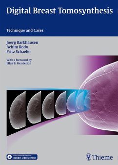 Digital Breast Tomosynthesis (eBook, PDF) - Barkhausen, Joerg; Rody, Achim; Schäfer, Fritz K. W.