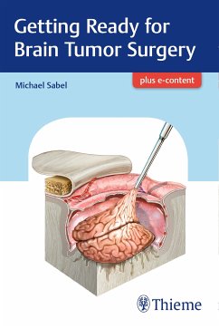 Getting Ready for Brain Tumor Surgery (eBook, PDF) - Sabel, Michael
