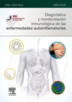 Diagnóstico y monitorización inmunológica de las enfermedades autoinflamatorias - Aróstegui Gorospe, Juan Ignacio