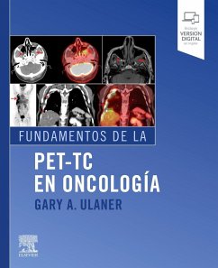 Fundamentos de la PET-TC en oncología - Ulaner, Gary A.