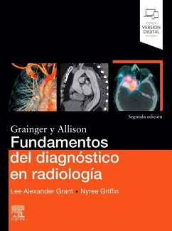 Fundamentos del diagnóstico en radiología - Grant, Lee Alexander