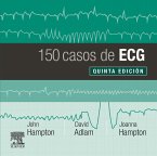 150 casos de ECG