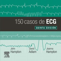 150 casos de ECG - Hampton, John R.