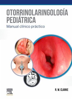 Otorrinolaringología pediátrica - Clarke, Ray W.