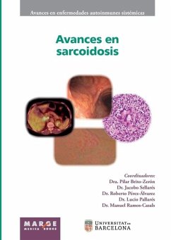 Avances en sarcoidosis - Cervera, Ricard