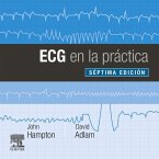 ECG en la práctica