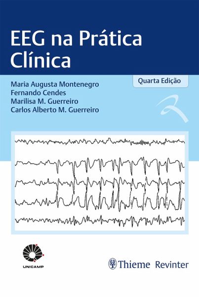 EEG na Prática Clínica (eBook, ePUB) EEG na Prática Clínica (eBook, ePUB)