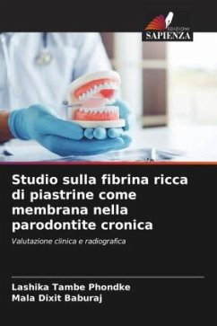 Studio sulla fibrina ricca di piastrine come membrana nella parodontite cronica - TAMBE PHONDKE, LASHIKA;DIXIT BABURAJ, MALA