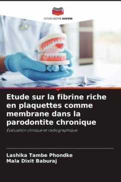 Etude sur la fibrine riche en plaquettes comme membrane dans la parodontite chronique - TAMBE PHONDKE, LASHIKA;DIXIT BABURAJ, MALA