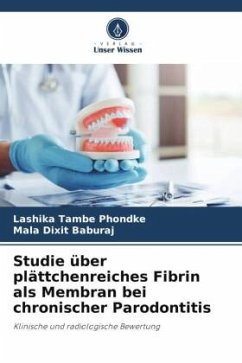 Studie über plättchenreiches Fibrin als Membran bei chronischer Parodontitis - TAMBE PHONDKE, LASHIKA;DIXIT BABURAJ, MALA