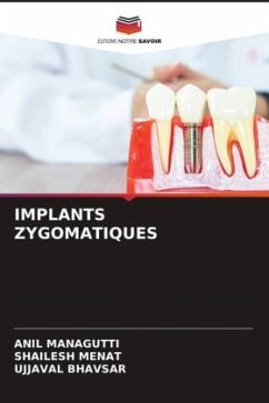 IMPLANTS ZYGOMATIQUES - Managutti, Anil;Menat, Shailesh;Bhavsar, Ujjaval