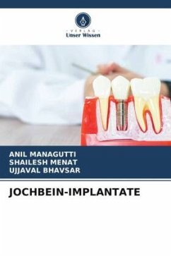 JOCHBEIN-IMPLANTATE - Managutti, Anil;Menat, Shailesh;Bhavsar, Ujjaval