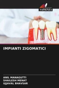 IMPIANTI ZIGOMATICI - Managutti, Anil;Menat, Shailesh;Bhavsar, Ujjaval