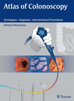 Atlas of Colonoscopy (eBook, ePUB) - Messmann, Helmut