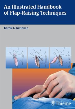 An Illustrated Handbook of Flap-Raising Techniques (eBook, ePUB) - Krishnan, Kartik G.
