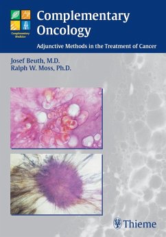 Complementary Oncology (eBook, PDF) - Beuth, Josef; Moss, Ralph W.