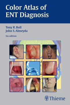 Color Atlas of ENT Diagnosis (eBook, PDF) - Bull, Tony R.; Almeyda, John S.