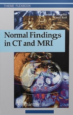 Normal Findings in CT and MRI (eBook, PDF) - Moeller, Torsten Bert; Reif, Emil