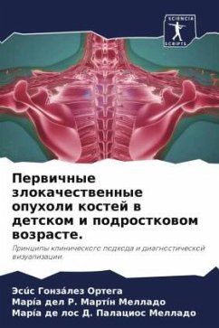 Perwichnye zlokachestwennye opuholi kostej w detskom i podrostkowom wozraste. - González Ortega, Jesús;Martín Mellado, María del R.;Palacios Mellado, María de los D.