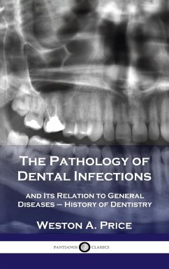 Pathology of Dental Infections - Price, Weston A.