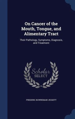 On Cancer of the Mouth, Tongue, and Alimentary Tract: Their Pathology, Symptoms, Diagnosis, and Treatment - Jessett, Frederic Bowreman