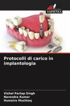 Protocolli di carico in implantologia - Singh, Vishal Partap;Kumar, Narendra;Mushtaq, Humaira