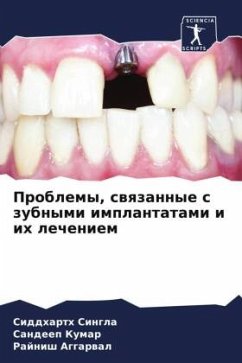 Problemy, swqzannye s zubnymi implantatami i ih lecheniem - Singla, Siddharth;Kumar, Sandeep;AGGARWAL, RAJNISH