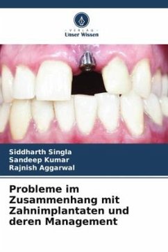 Probleme im Zusammenhang mit Zahnimplantaten und deren Management - Singla, Siddharth;Kumar, Sandeep;AGGARWAL, RAJNISH