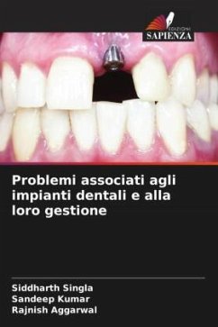 Problemi associati agli impianti dentali e alla loro gestione - Singla, Siddharth;Kumar, Sandeep;AGGARWAL, RAJNISH